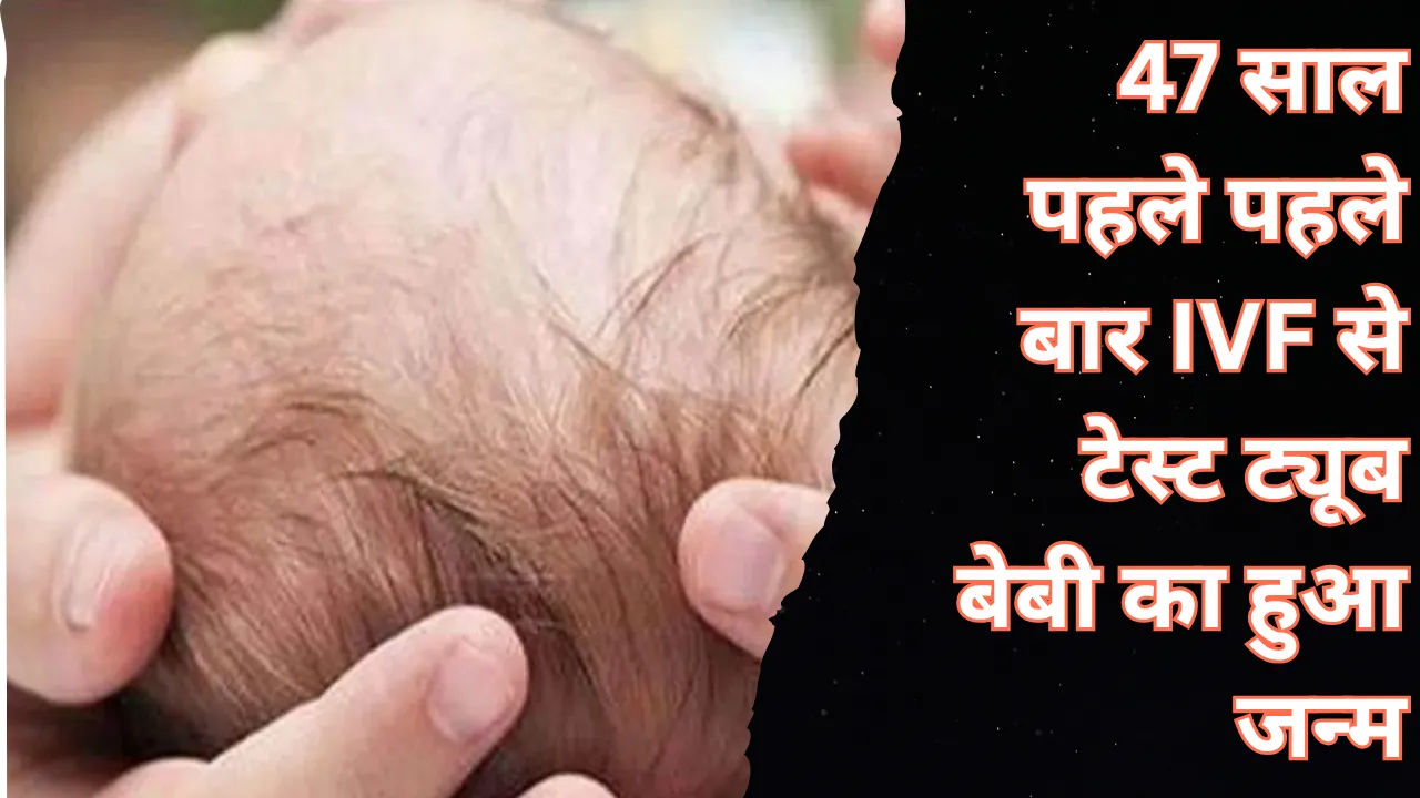 25 जुलाई: 47 साल पहले IVF से पहली बार टेस्ट ट्यूब बेबी का हुआ जन्म