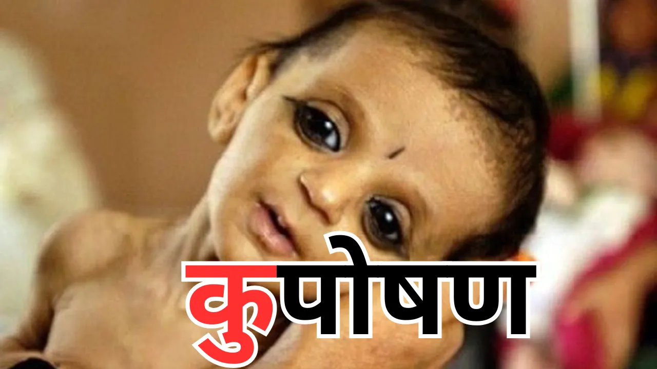 यूपी के बच्चे होंगे कुपोषण मुक्त, आंगनवाड़ी केंद्रों की निगरानी करेंगे 100 नोडल अधिकारी