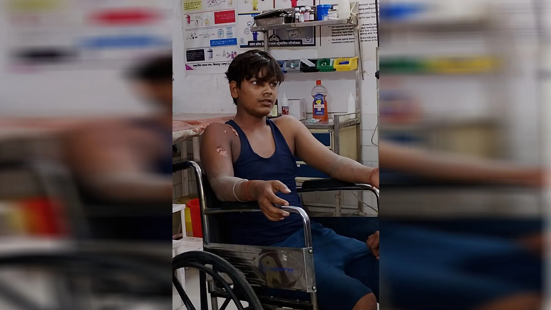 रामपुर: छत से गुजर रही हाईटेंशन लाइन की चपेट में आकर युवक झुलसा