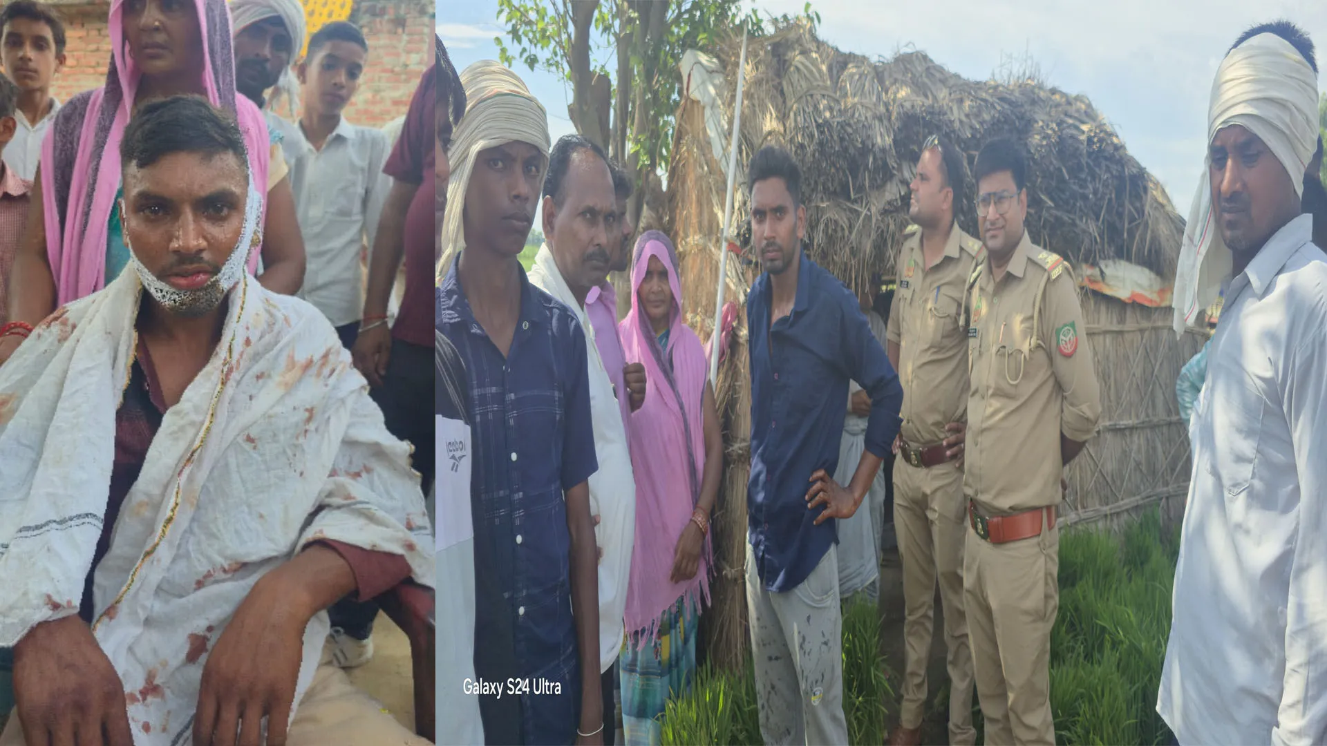 शाहजहांपुर: खेत में खाद लगा रहे युवक पर बाघ का हमला...गंभीर रूप से घायल