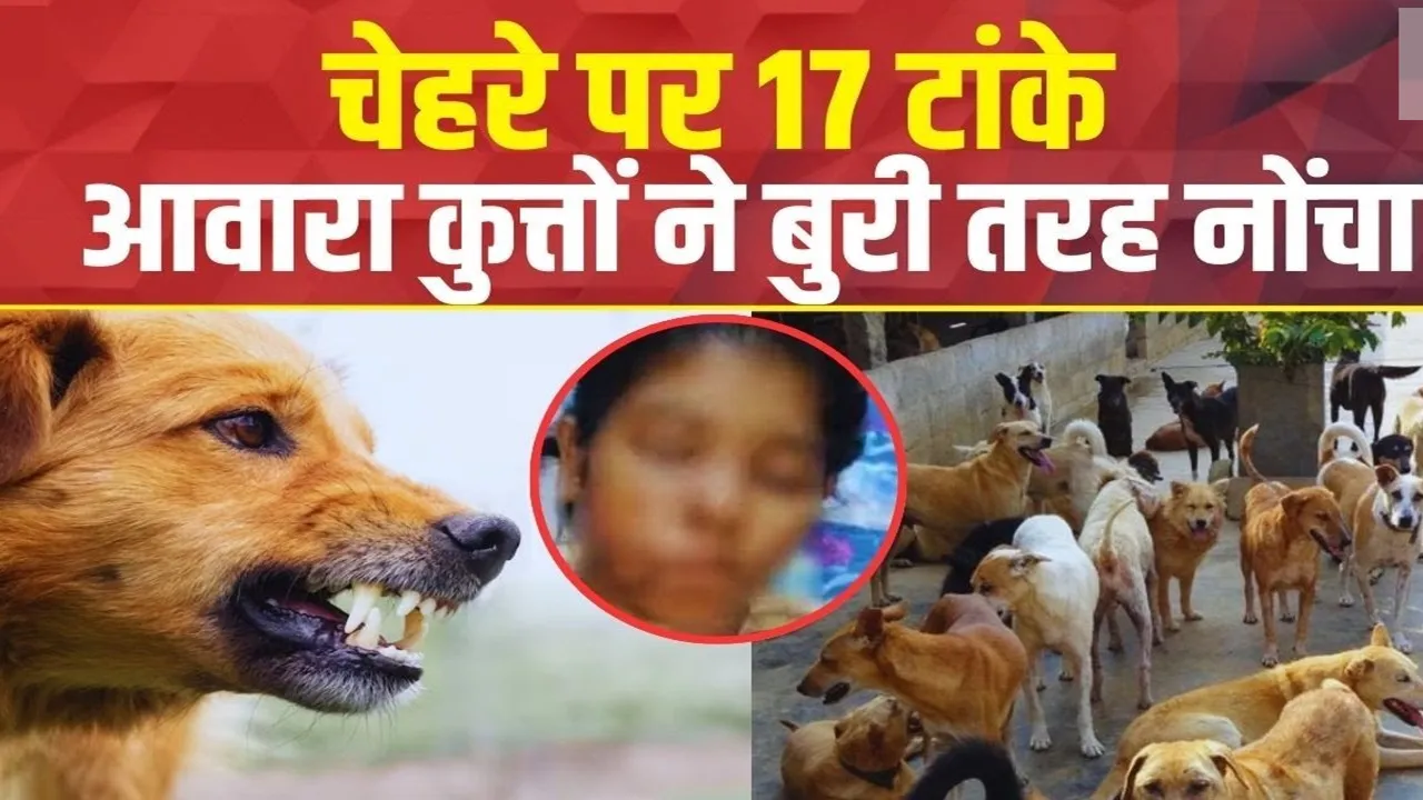 कानपुर में आवारा कुत्तों ने छात्रा को बुरी तरह नोंचा, चेहरे पर लगे 17 टांके 