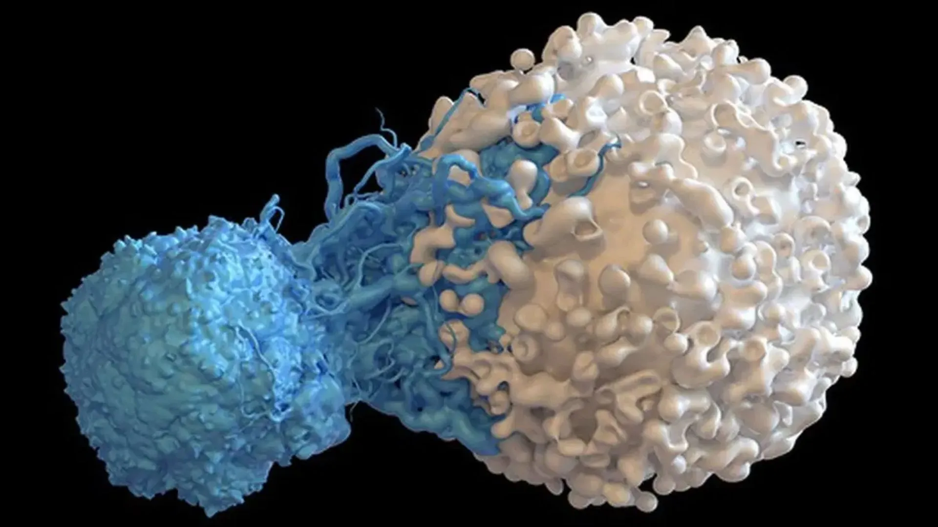 मौत के मुहाने से खींचकर लौटा दी जिंदगी : GSVM मेडिकल कॉलेज में किया गया दुर्लभ कैंसर का सफल ऑपरेशन
