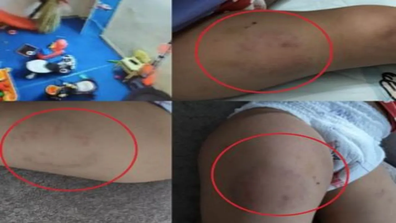 डे-केयर में 15 माह की बच्ची से क्रूरता, CCTV फुटेज में थप्पड़, सिर पटका और दांत से काटने की घटना उजागर