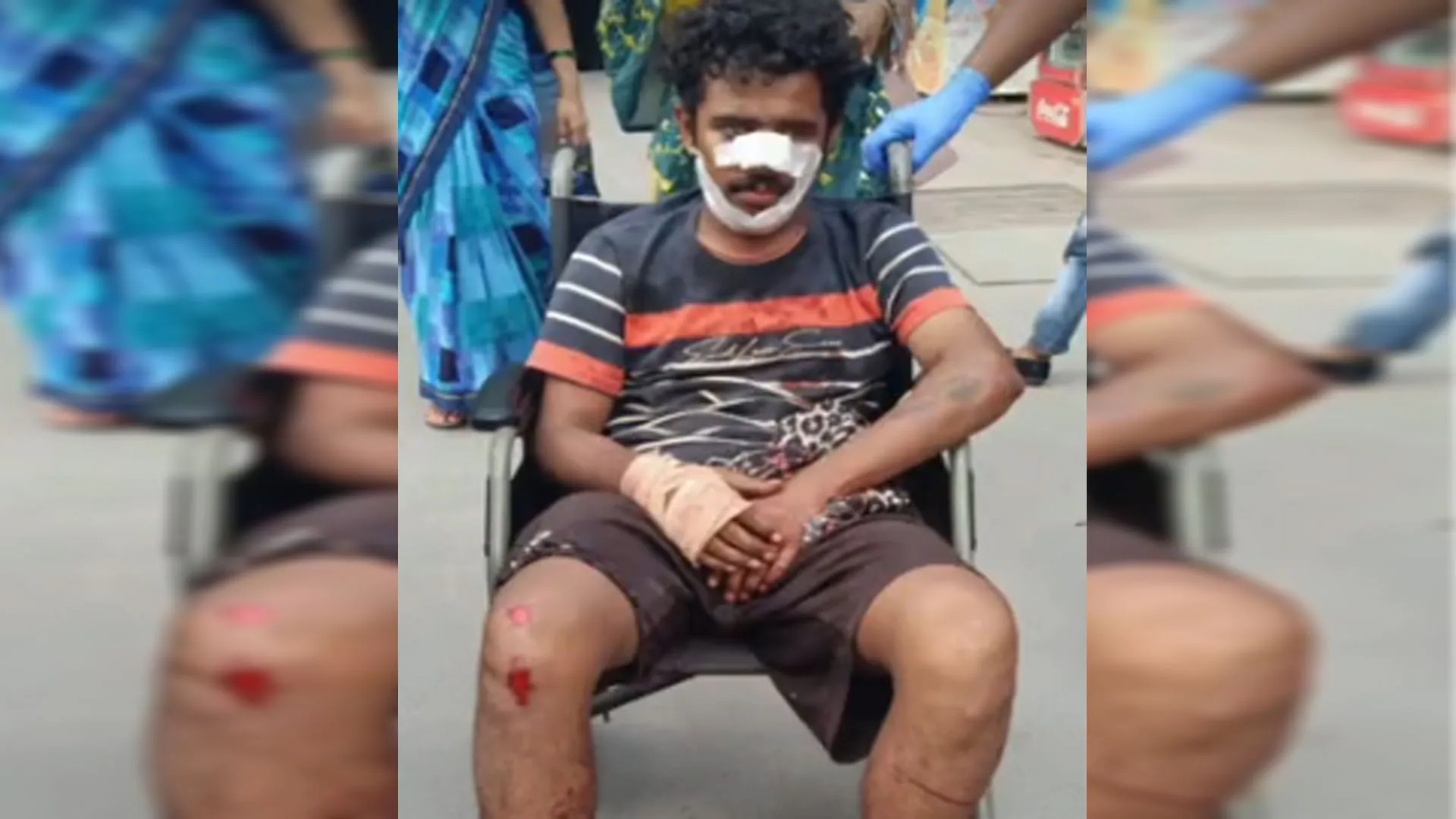 Bareilly: मांझे की चपेट में आने से स्कूटी सवार युवक की गर्दन कटी