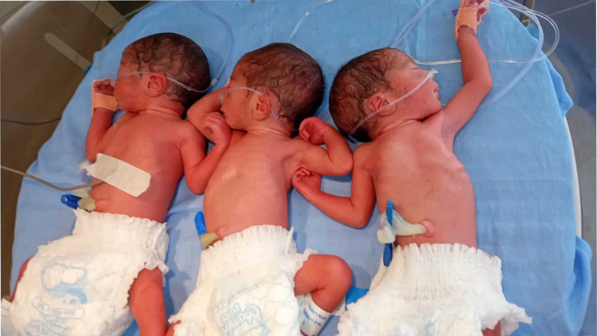 Bareilly: जिला महिला अस्पताल में गूंजी तीन किलकारियां...महिला ने ट्रिप्लेट बच्चों को दिया जन्म