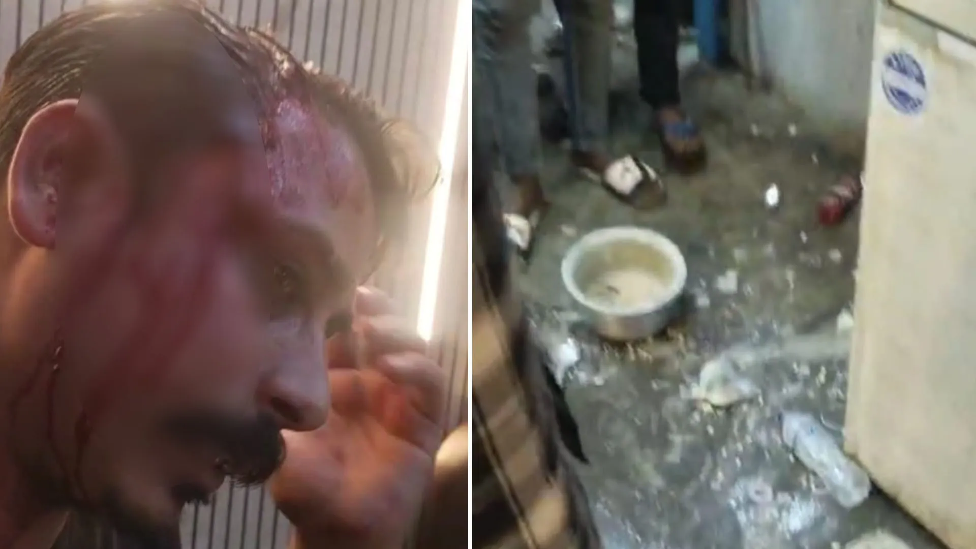 लखीमपुर खीरी: हिंदू संगठन का नेता बताकर ढाबा मालिक से मांगी रंगदारी...तमंचे से हमला और लूटी चेन