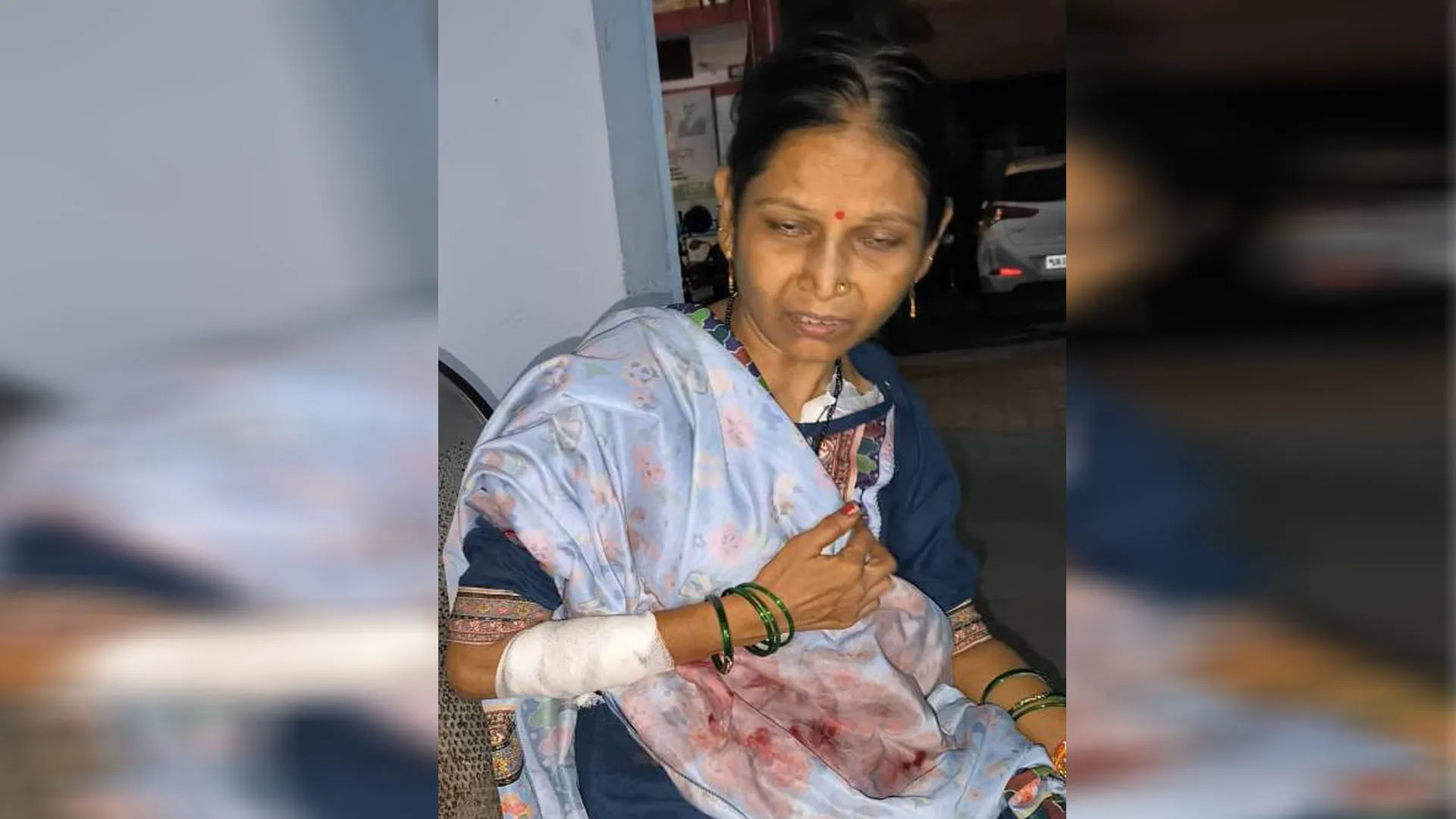 पीलीभीत : बंटवारे के विवाद में मां-बेटे पर हमला, चाकू से किए वार
