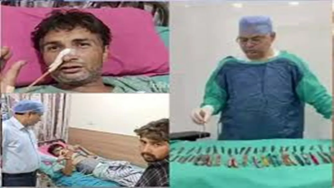 हापुड़: मरीज के पेट से निकली 29 चम्मच, 19 टूथब्रश और दो पेन, डॉक्टर भी रह गए दंग