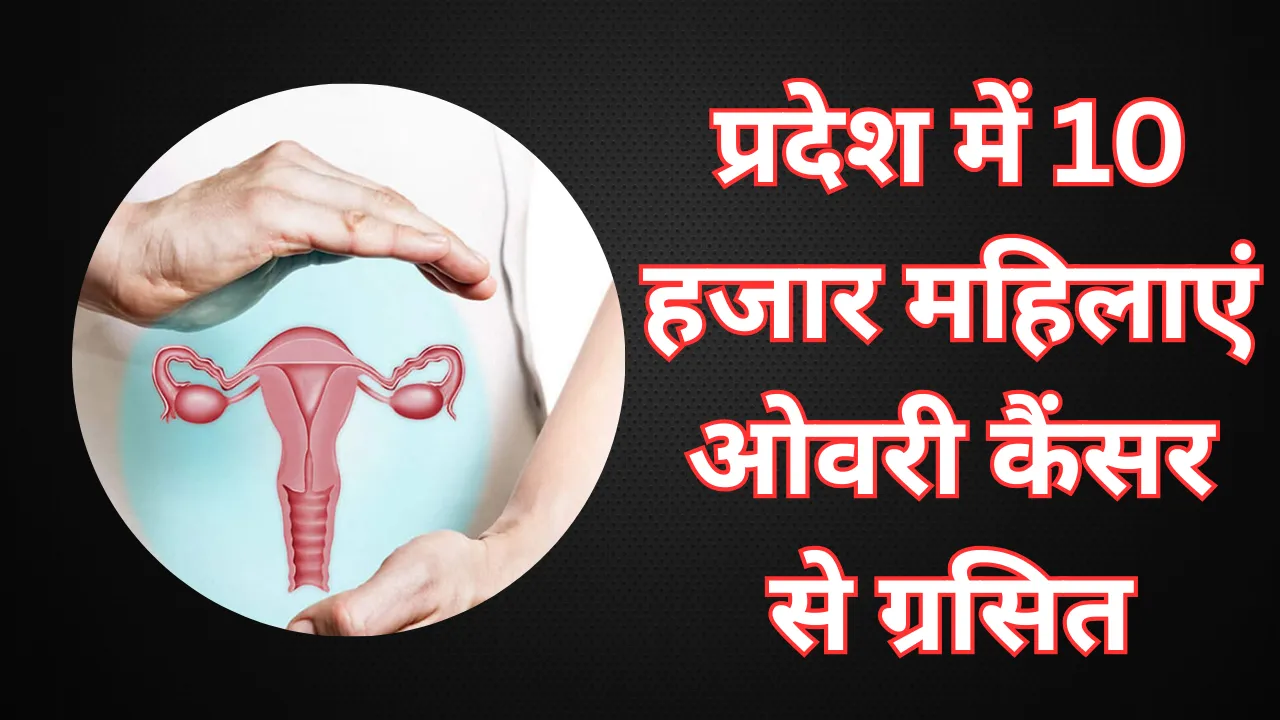 Alert: प्रदेश में 10 हजार महिलाएं ओवरी कैंसर से ग्रसित, केजीएमयू ने साझा किए डराने वाले आंकड़े जानकारी