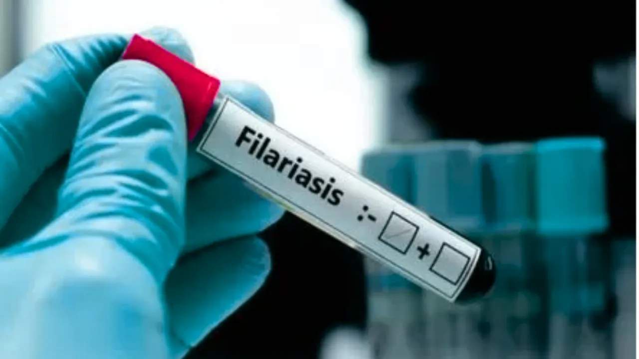 हमें नहीं खानी फाइलेरिया की दवा... 86 फीसदी लोगों ने किया दवा लेने से था इंकार, अब मिली सफलता