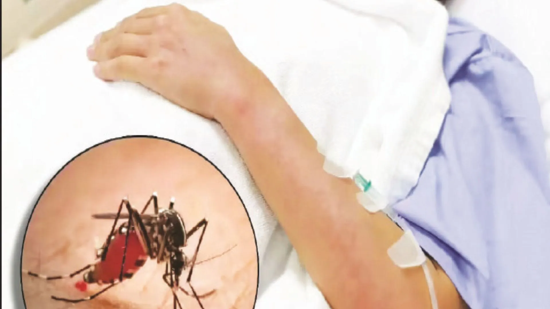 अयोध्या के इस गांव में संक्रामक रोगों का प्रकोप: स्वास्थ्य विभाग ने लगाया कैंप, मलेरिया-डेंगू के मरीज अस्पताल में भर्ती 