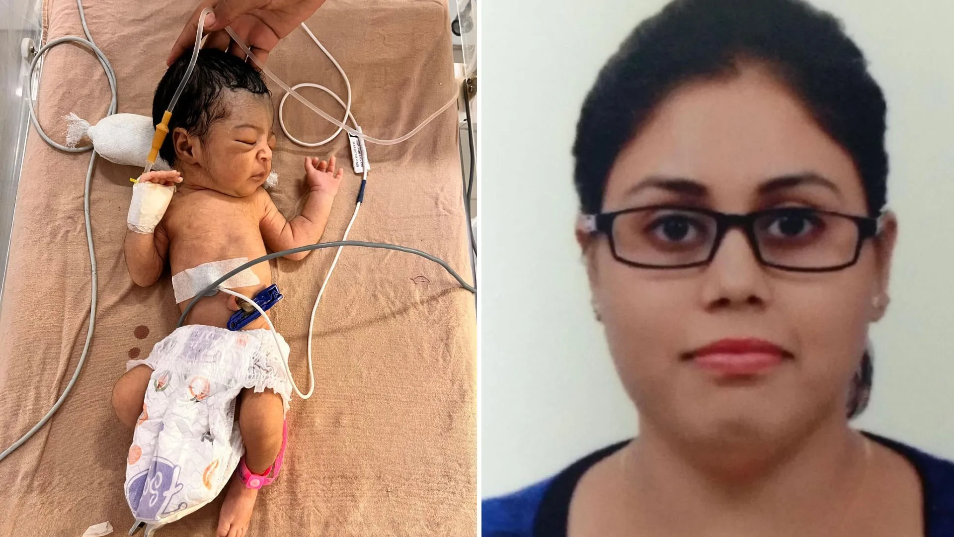 Moradabad : नवजात की सांसों से डॉक्टरों ने जोड़ी अपनी धड़कन, दिया नया जीवन