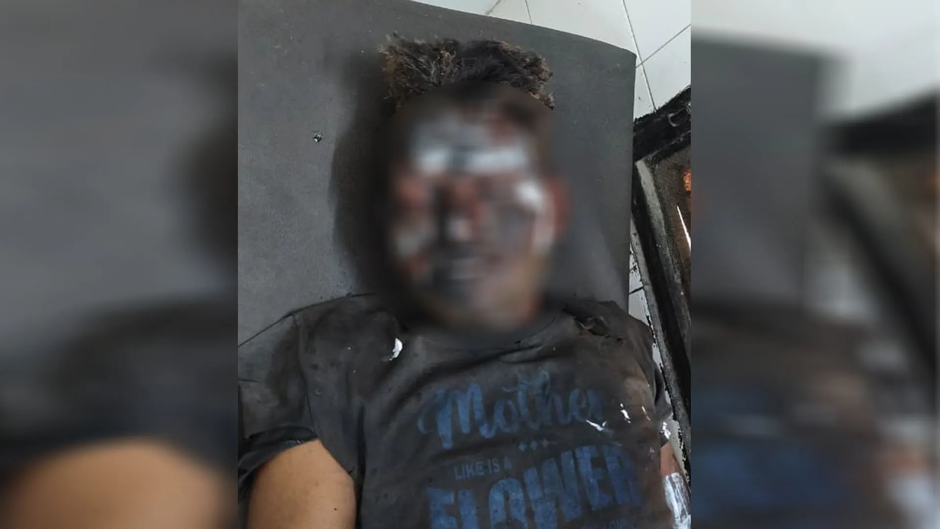 UP : टायर फैक्ट्री में बॉयलर फटने से मजदूर झुलसा, हालत नाजुक, मुरादाबाद रेफर किया गया