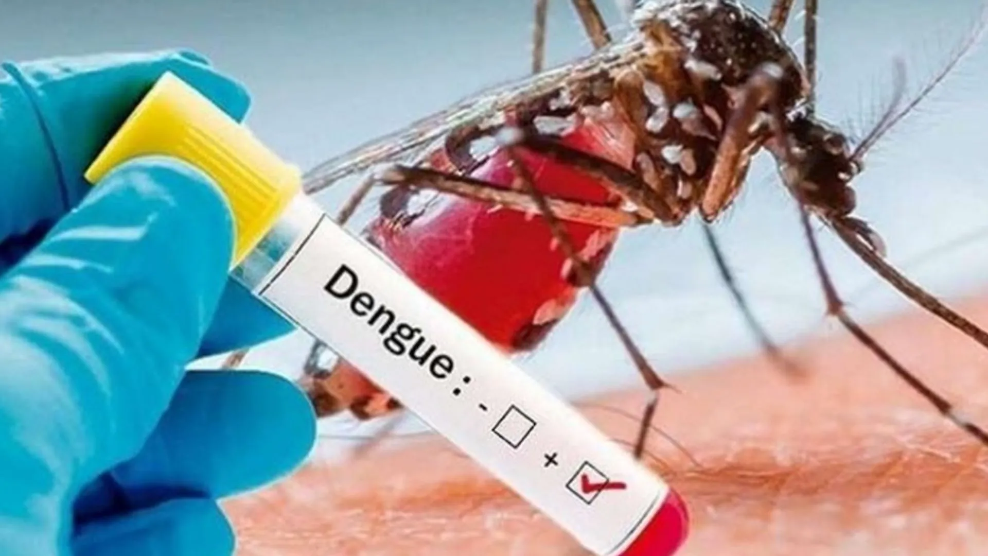 आरडीटी किट से नहीं एलाइजा टेस्ट से होती है डेंगू की पुष्टि, CMO ने निजी पैथोलॉजी व डायग्नोस्टिक सेंटर संचालकों के साथ की बैठक