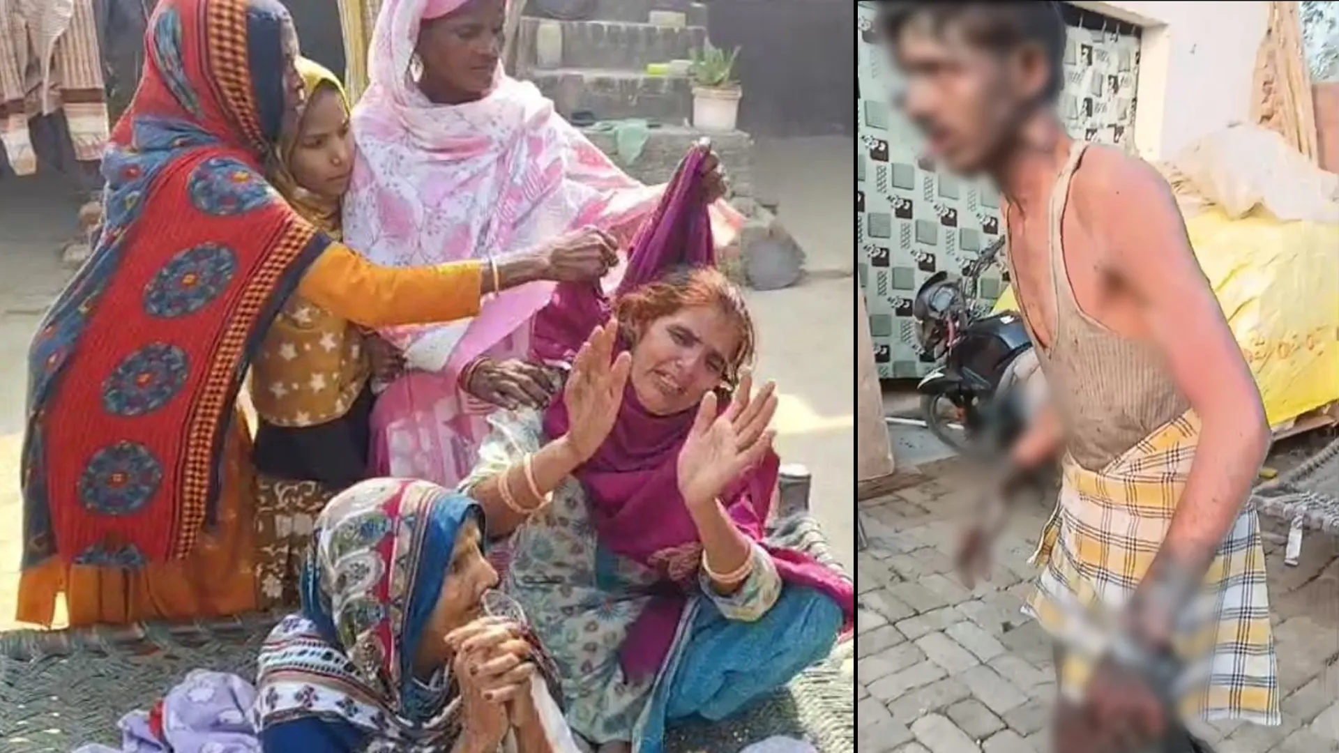 बदायूं : युवक को खंभे से बांधकर पेट्रोल डालकर लगाई आग, हालत नाजुक