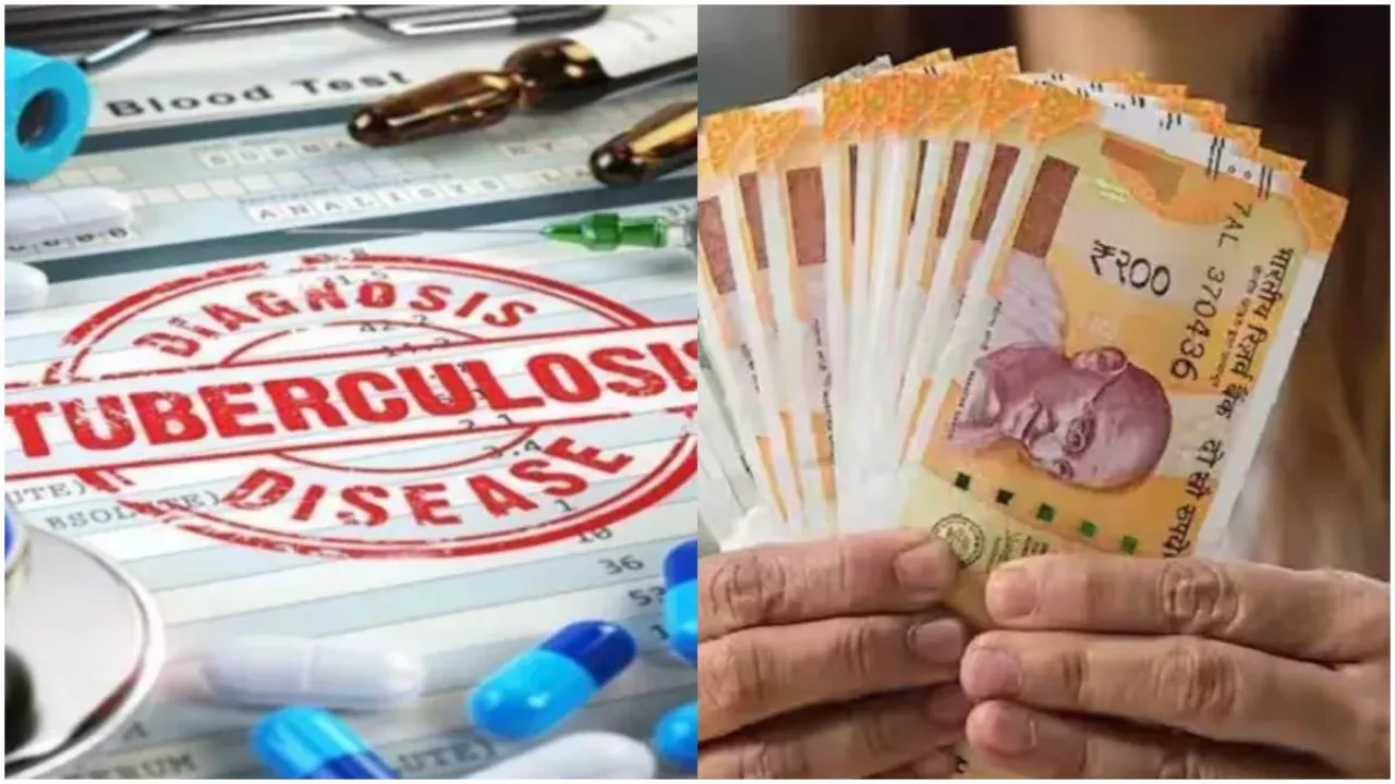 टीबी मरीजों का इंतजार अभी और लंबा... छह माह से नहीं मिल पा रहा पोषण भत्ता