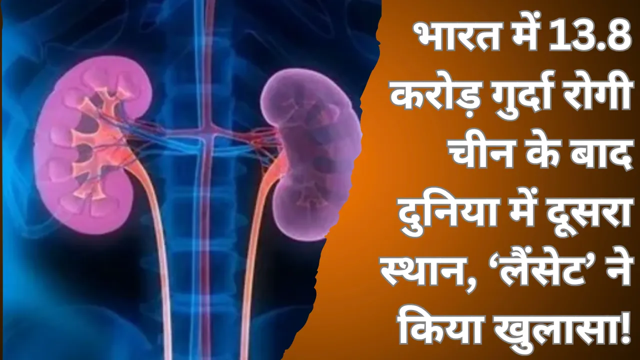 भारत में 13.8 करोड़ गुर्दा रोगी... चीन के बाद दुनिया में दूसरा स्थान, ‘लैंसेट’ अध्ययन ने किया खुलासा!