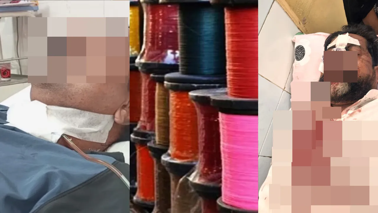 Lucknow News: चायनीज मांझा बन रहा जानलेवा...खतरे में पड़ी जिंदगी