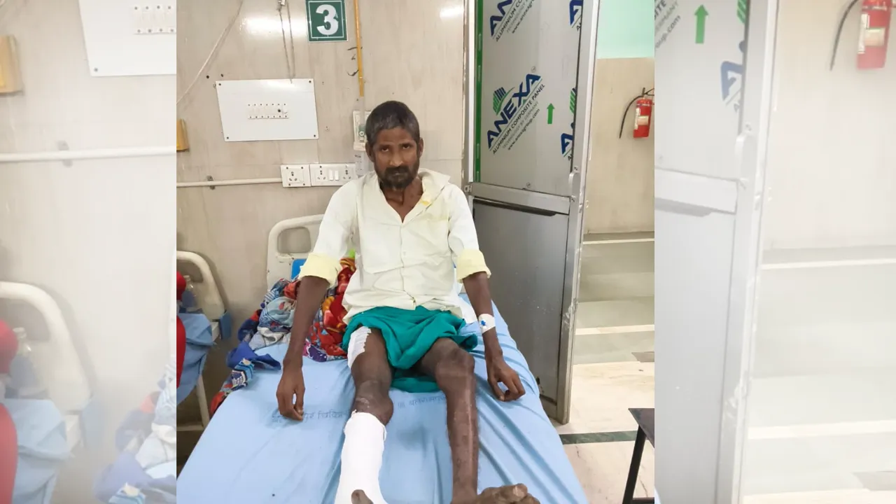 Lucknow News: लावारिस का ऑपरेशन किया, अपने पैसे से लगाया इम्प्लांट