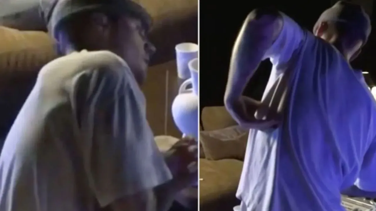 इलेक्ट्रिक स्केटबोर्ड से गिरने के बाद जस्टिन बीबर का दर्द आया सामने, फैंस से कहा- ‘My rib hurts so ...