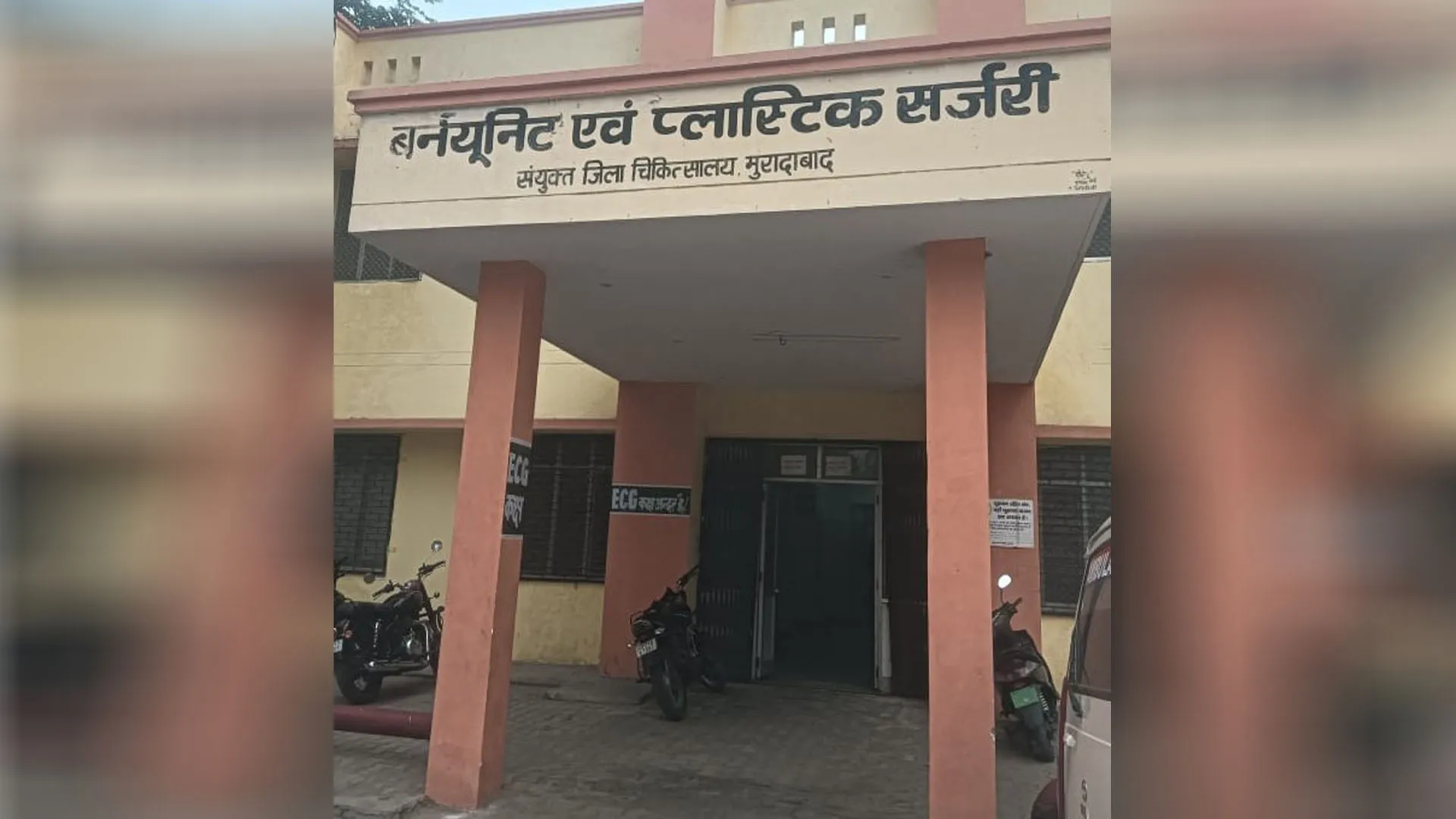 Moradabad: 1.99 करोड़ की बर्न यूनिट अब भी प्लास्टिक सर्जन के इंतजार में