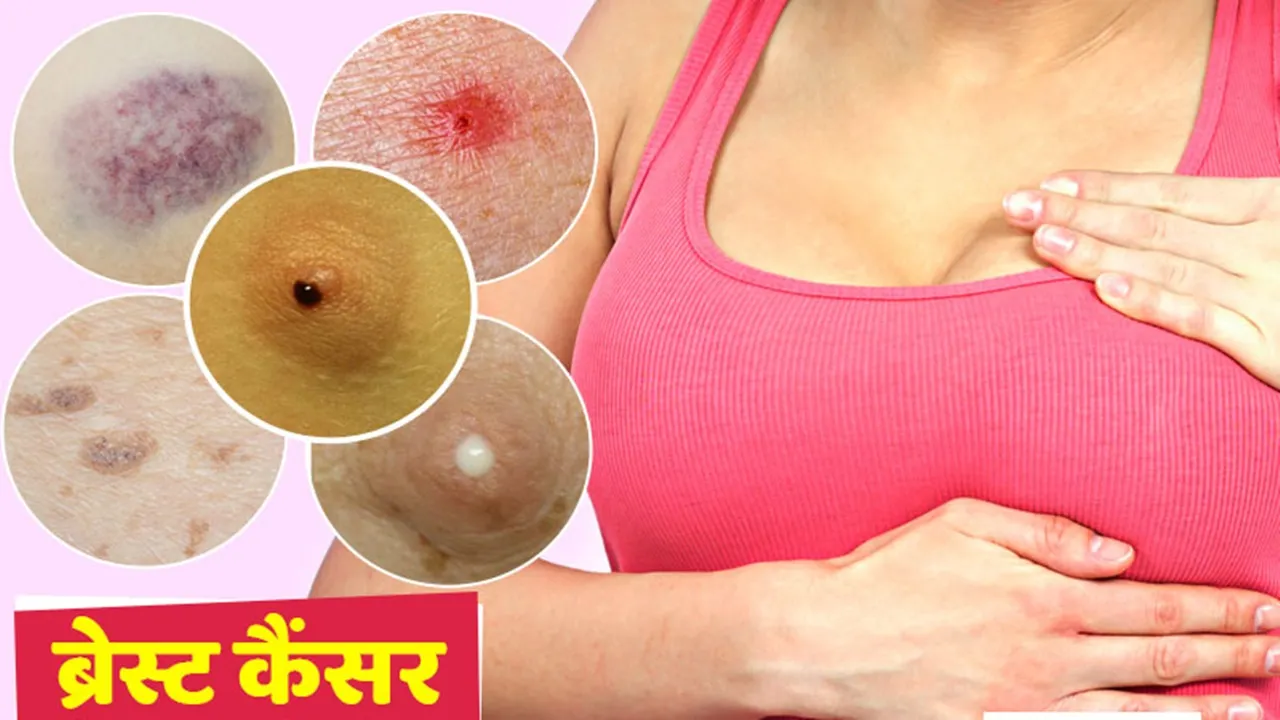 KGMU News: अब स्तन कैंसर की चंद घंटों में हो सकेगी पहचान, केजीएमयू को मिला वियरेबल डिवाइस का पेटेंट 