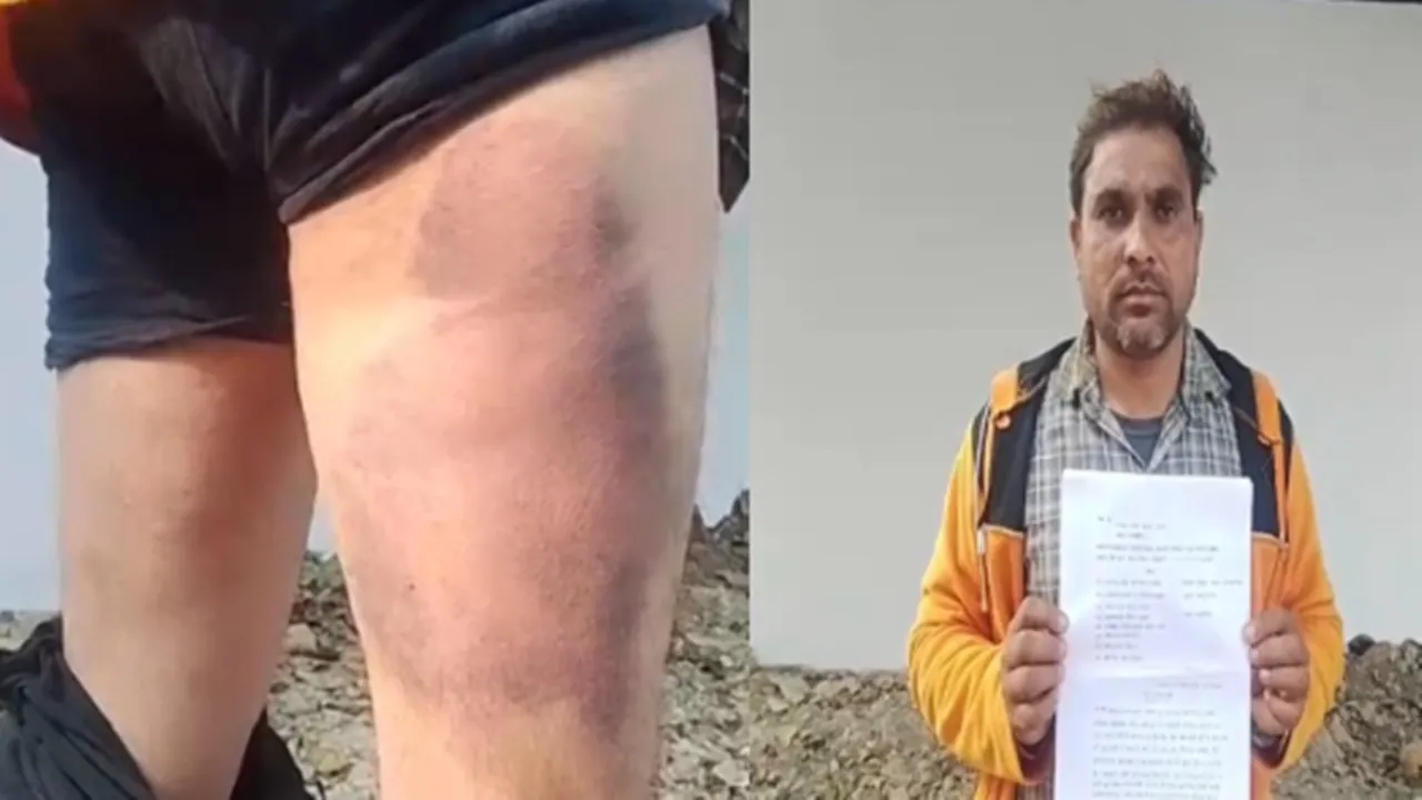 रायबरेली : परशदेपुर पुलिस पर बर्बरता का आरोप, पट्टे से युवक की जमकर पिटाई