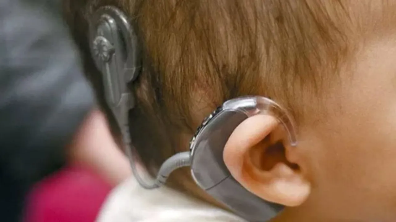 अब बच्चों को सुनने-बोलने की मिलेगी नई ताकत, SGPGI की पहल से कॉक्लियर इम्प्लांट होगा आसान