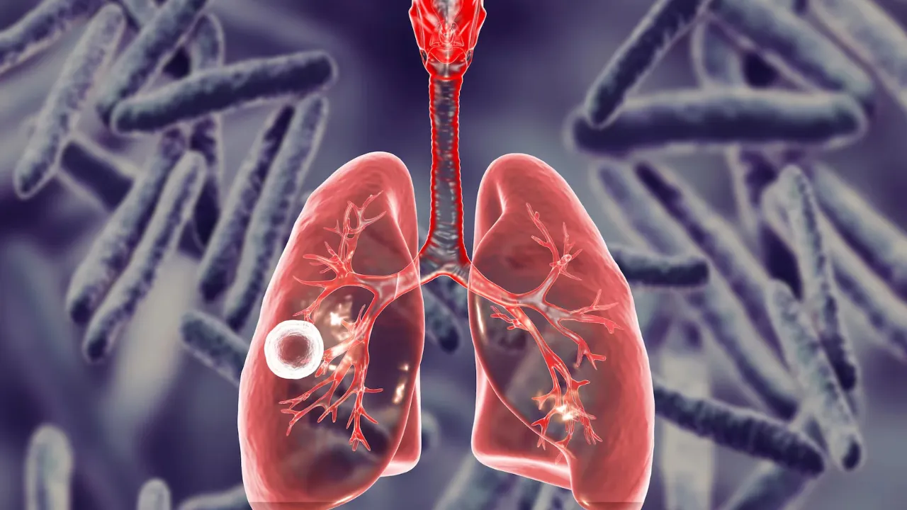 फरवरी से शुरू होगा 100 दिवसीय सघन टीबी रोगी खोज अभियान, सांसद से पार्षद तक जनप्रतिनिधियों की होगी भागीदारी, इन वर्गों पर होगा स्पेशल फोकस