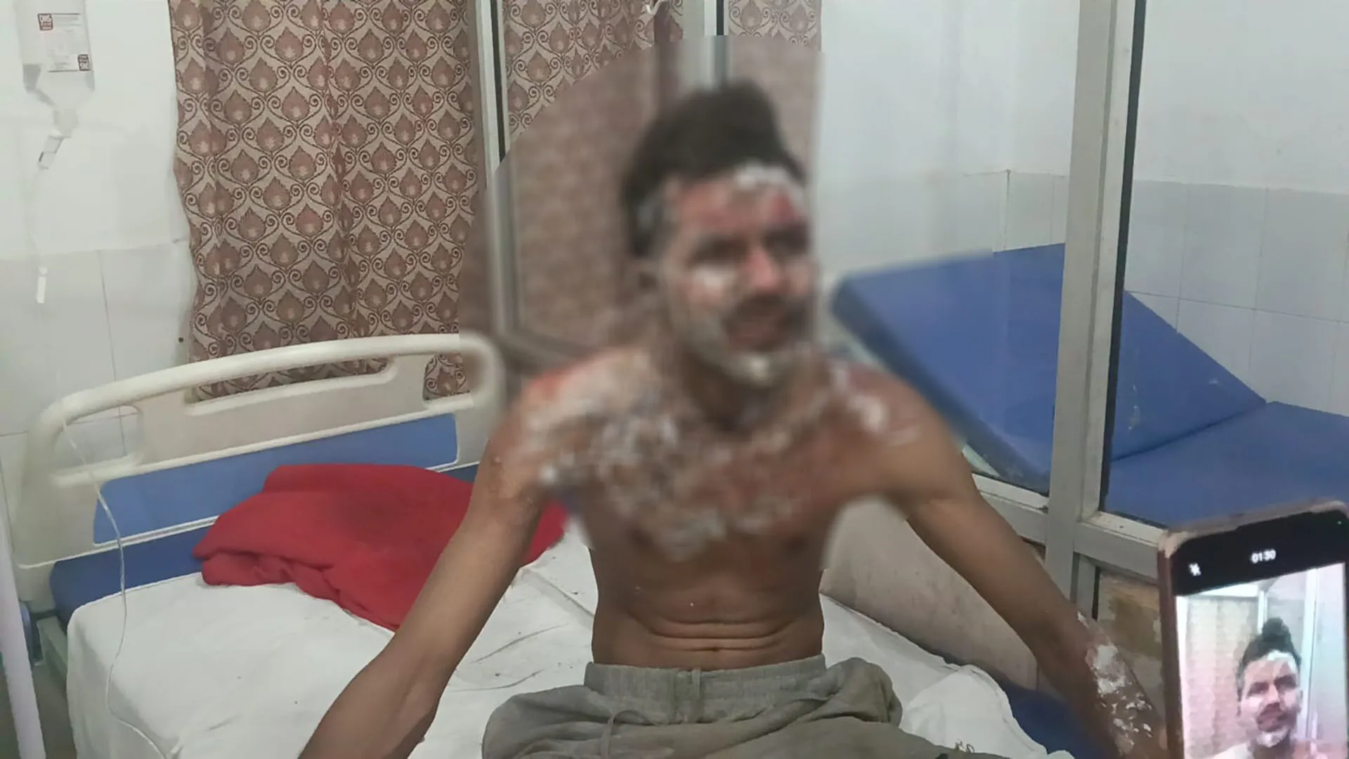 Bareilly : डिलीवरी बॉय ने थाने के गेट पर खुद को लगाई आग...वजह परेशान करने वाली है