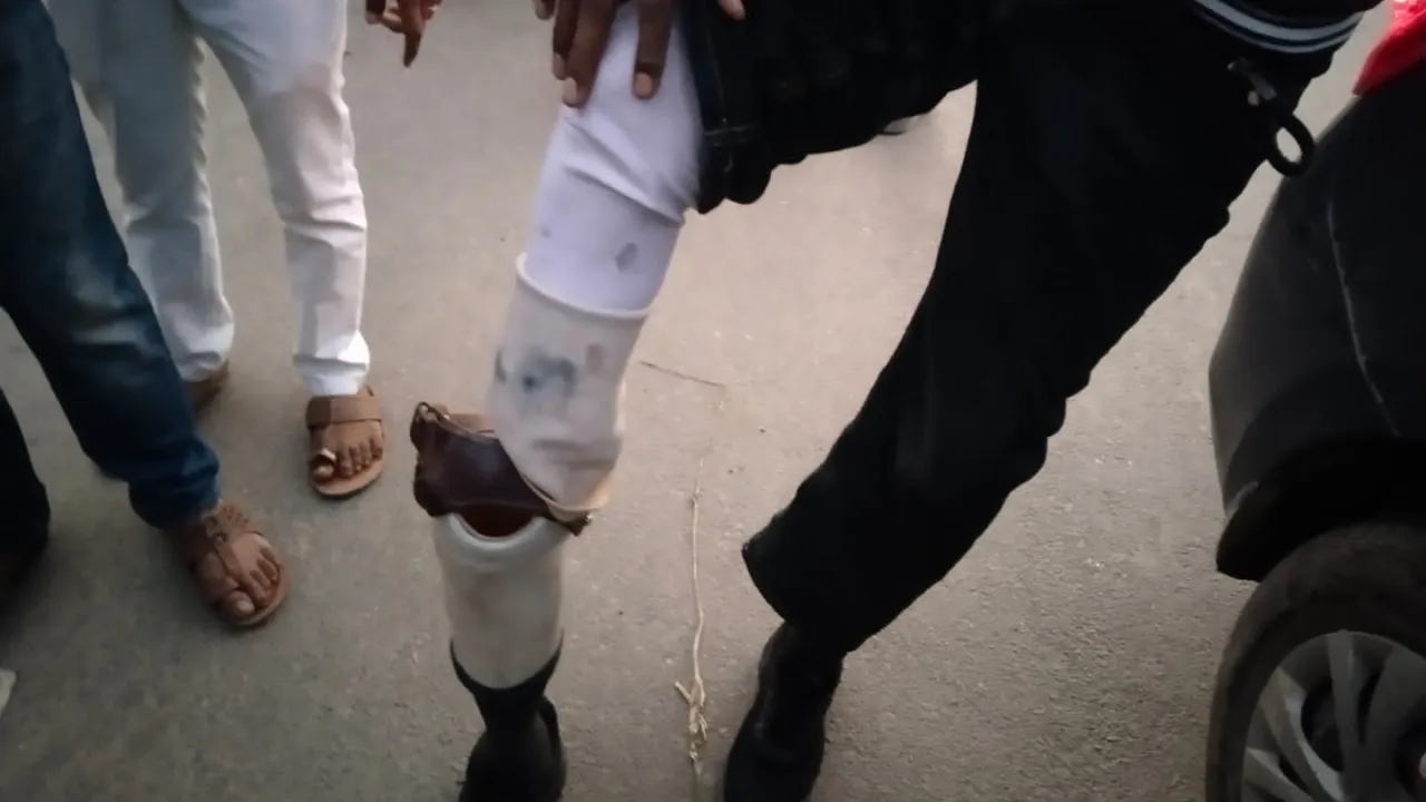 लखनऊ में छात्रों का खूनी संघर्ष: पुनर्वास विश्वविद्यालय और पॉलिटेक्निक के बीच पथराव, कई गाड़ियों में तोड़फोड़, आधा दर्जन से अधिक घायल