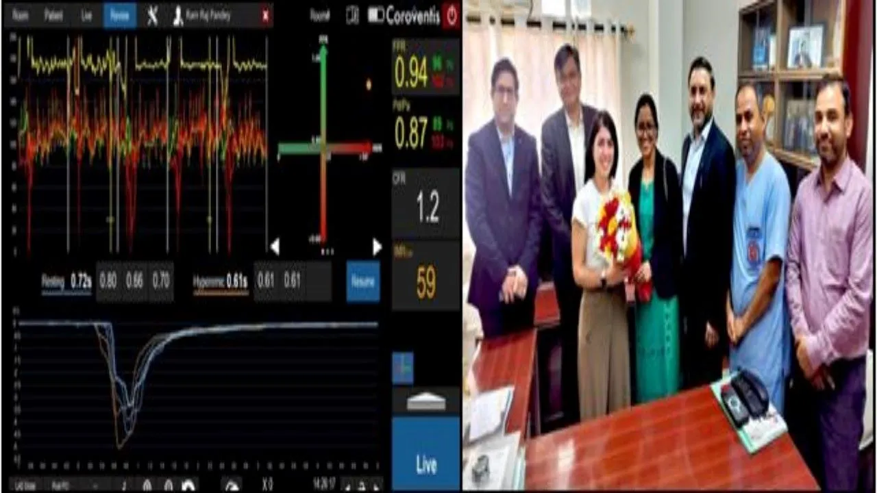 UP में पहली बार शुरू हुआ Coroventis तकनीक से इलाज  : KGMU में दिल के मरीजों को मिलेगी राहत