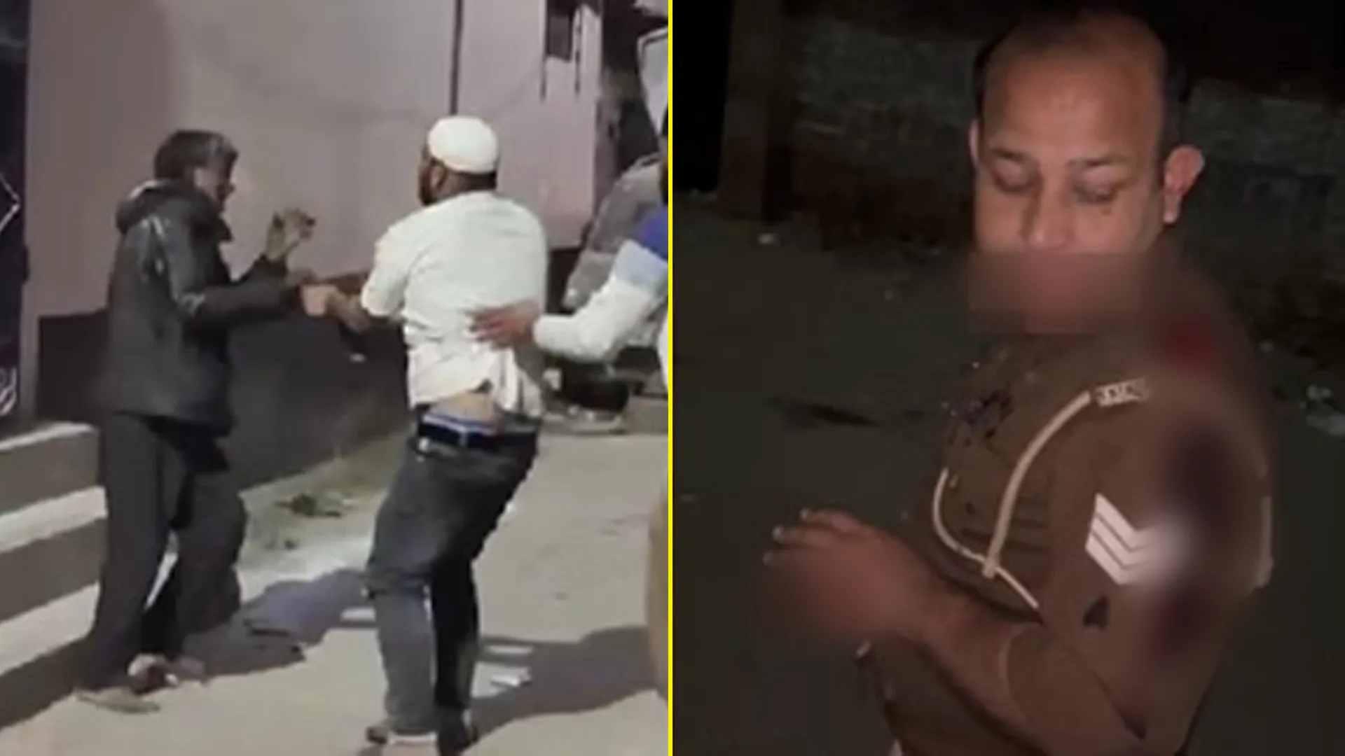 अमरोहा: गश्त पर निकले सिपाही पर युवक का जानलेवा हमला, गंडासे से कंधे और कान पर किए वार