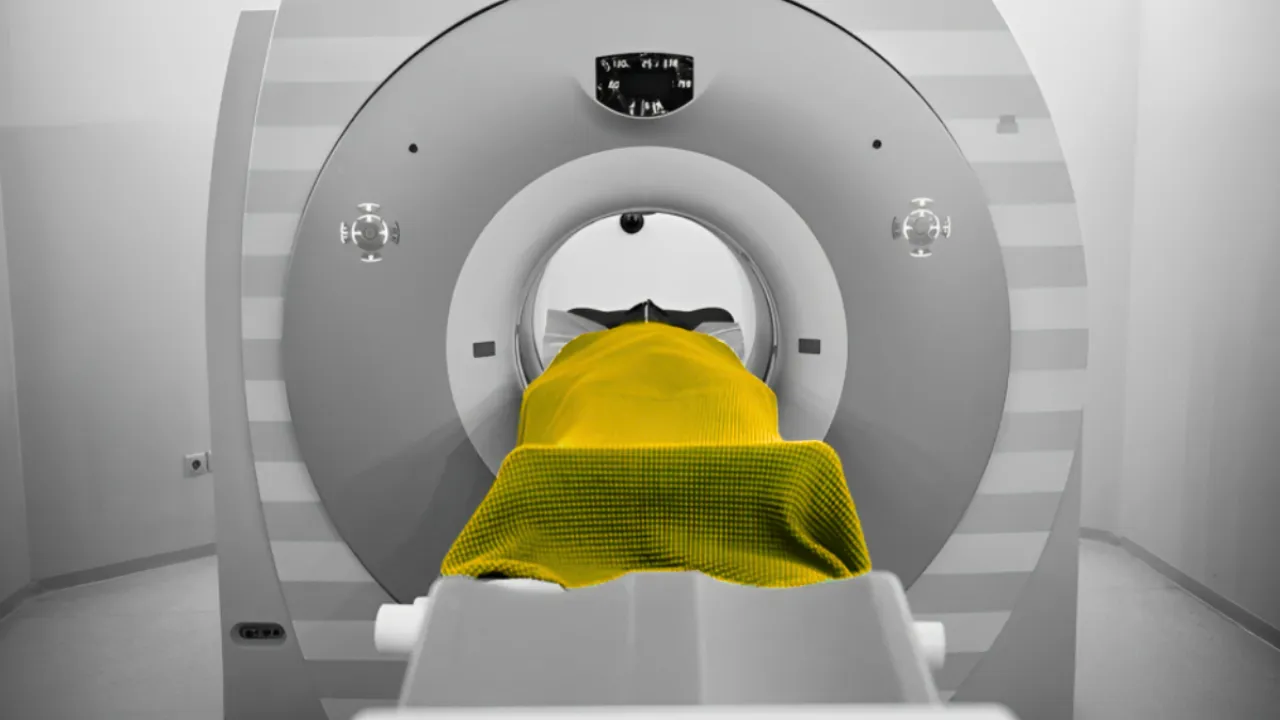 Good News: PET स्कैन से कैंसर की सटीक पहचान संभव, इलाज में भी खुलीं नई राहें