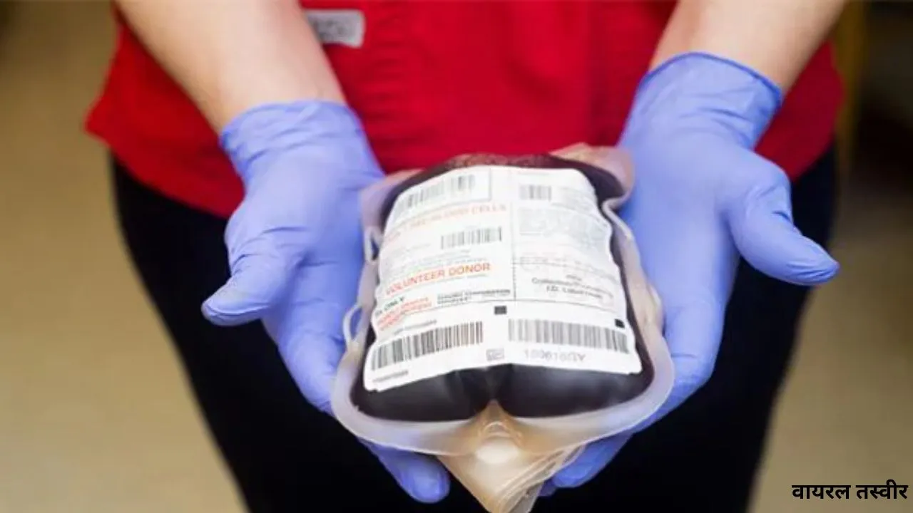 केजीएमयू में खून की कमी से टालने पड़ रहे ऑपरेशन,  प्रशासन ने लोगों से की रक्तदान की अपील