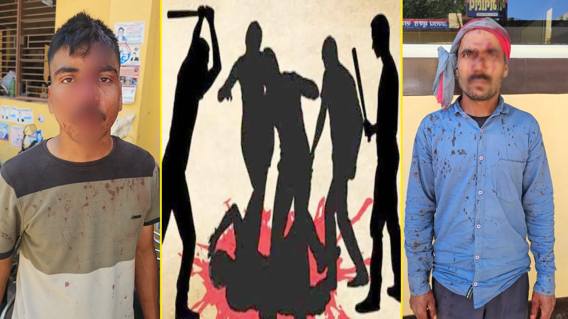 बरेली में खूनी संघर्ष : प्रधान और पूर्व प्रधान गुटों में चले लाठी-डंडे, 12 से ज्यादा घायल!