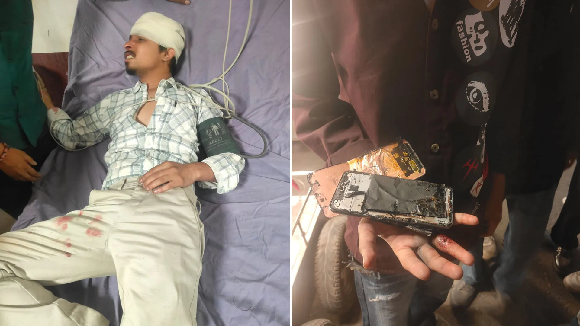 Bareilly: भाजपा नेता के भाई की शादी में बवाल, बरातियों को पीटा