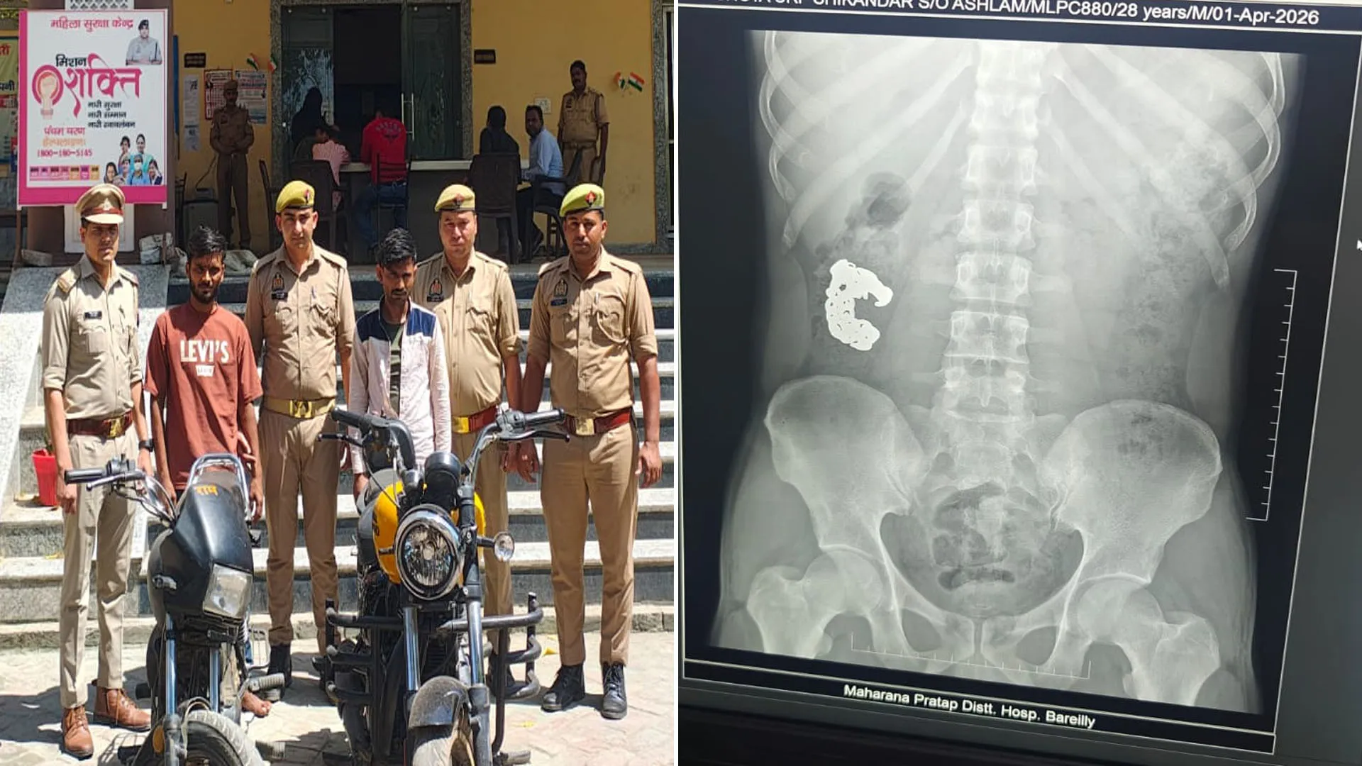 Bareilly: शातिर चोर की करतूत...पुलिस ने पकड़ा तो निगल गया चांदी का ब्रेसलेट, कराया गया एक्स-रे