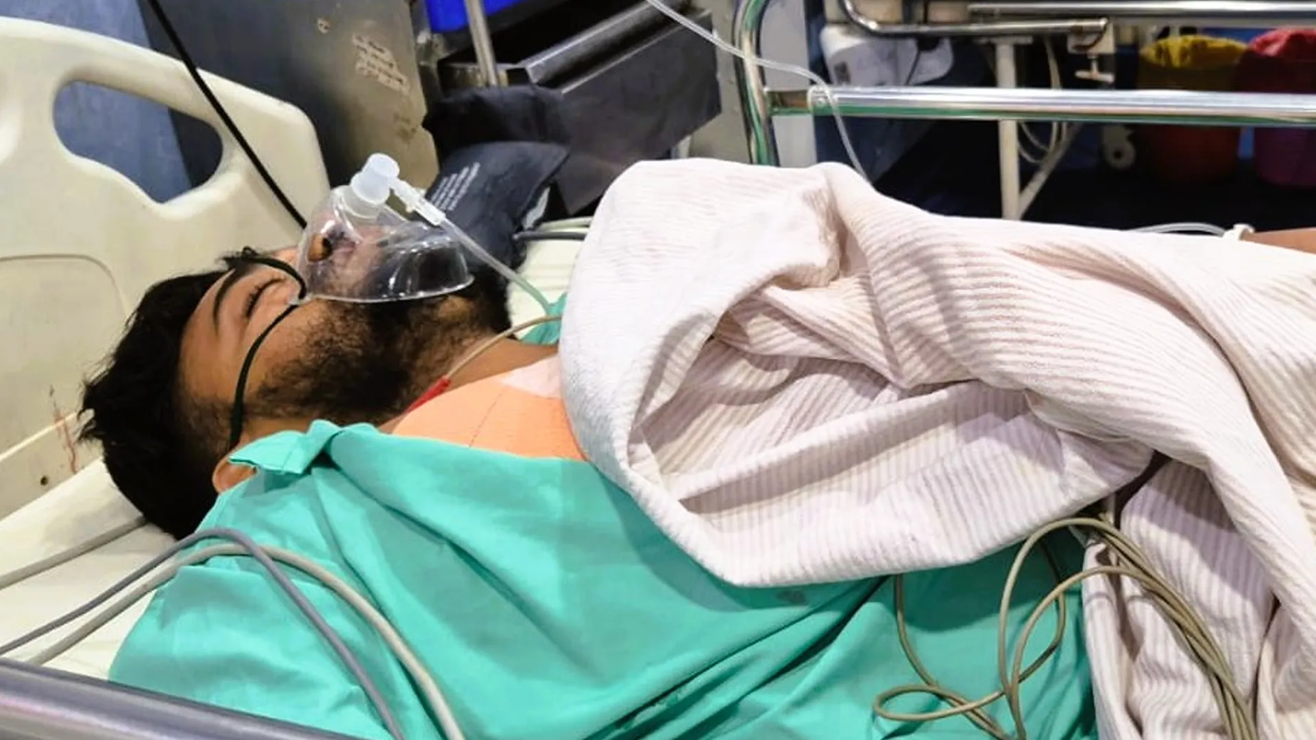 Moradabad पुरानी रंजिश में दो गुटों के बीच ताबड़तोड़ फायरिंग के बाद किला तिराहा पर दहशत