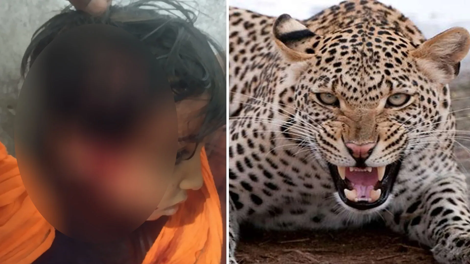 Moradabad: चारपाई से बच्ची को उठा ले गया तेंदुआ, ग्रामीणों ने छुड़ाया, हालत गंभीर