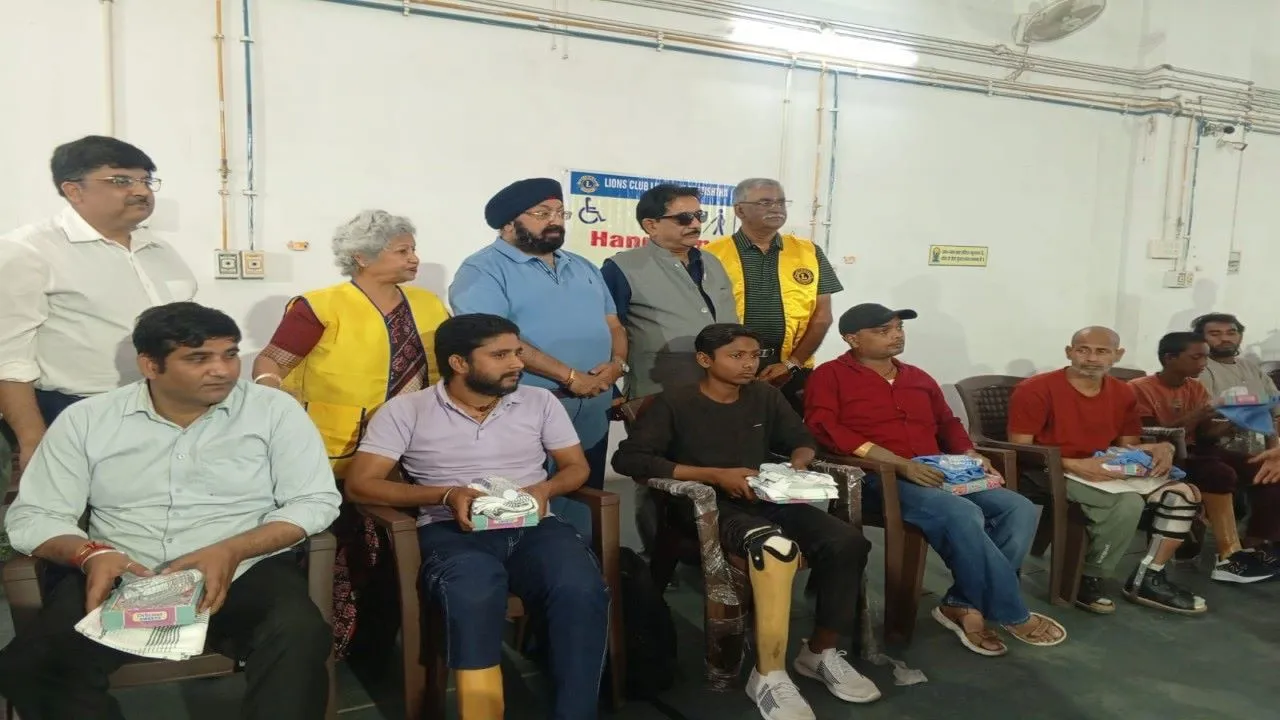 लखनऊ: केजीएमयू में दिव्यांगों को बांटे गए 50 हजार के कृत्रिम अंग