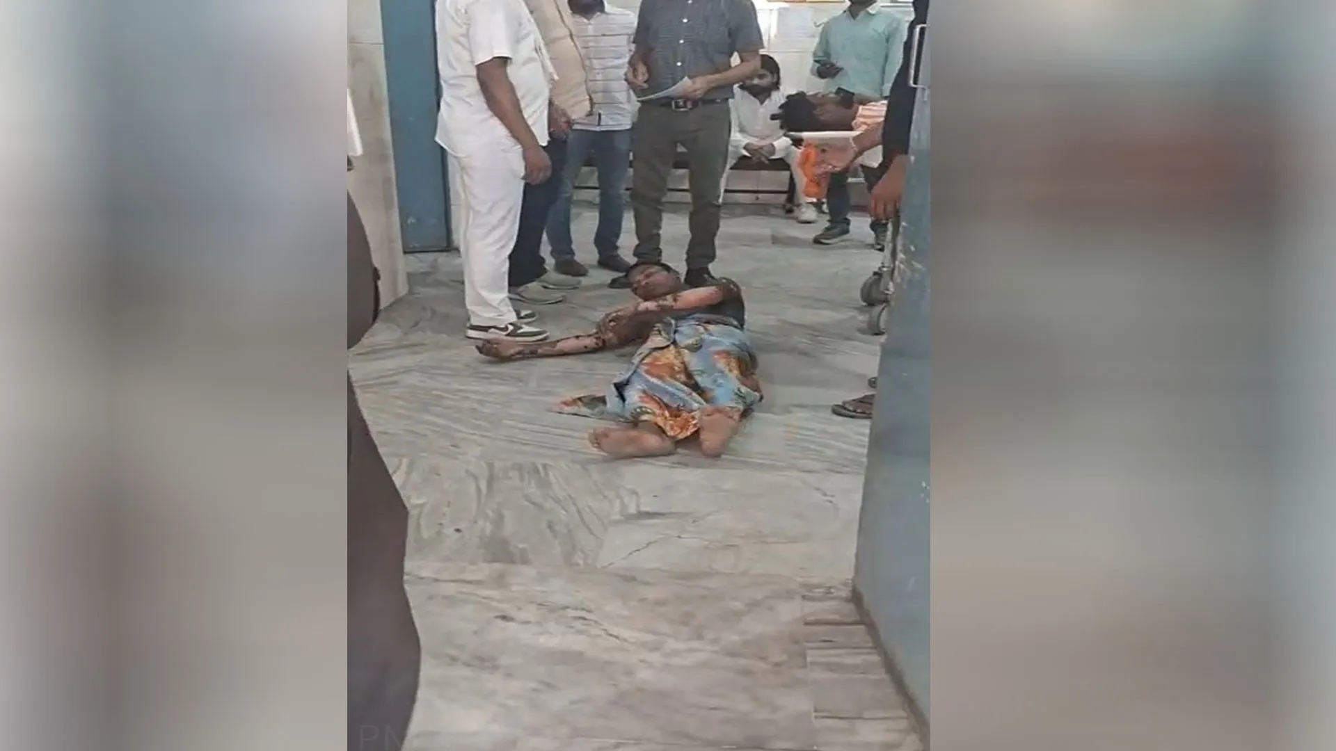 Bareilly:बगैर एंबुलेंस के ठेली पर मरीज, टैंपो में लाश के बाद अब झुलसे युवक की चीखों से सामने आया सिस्टम का सच