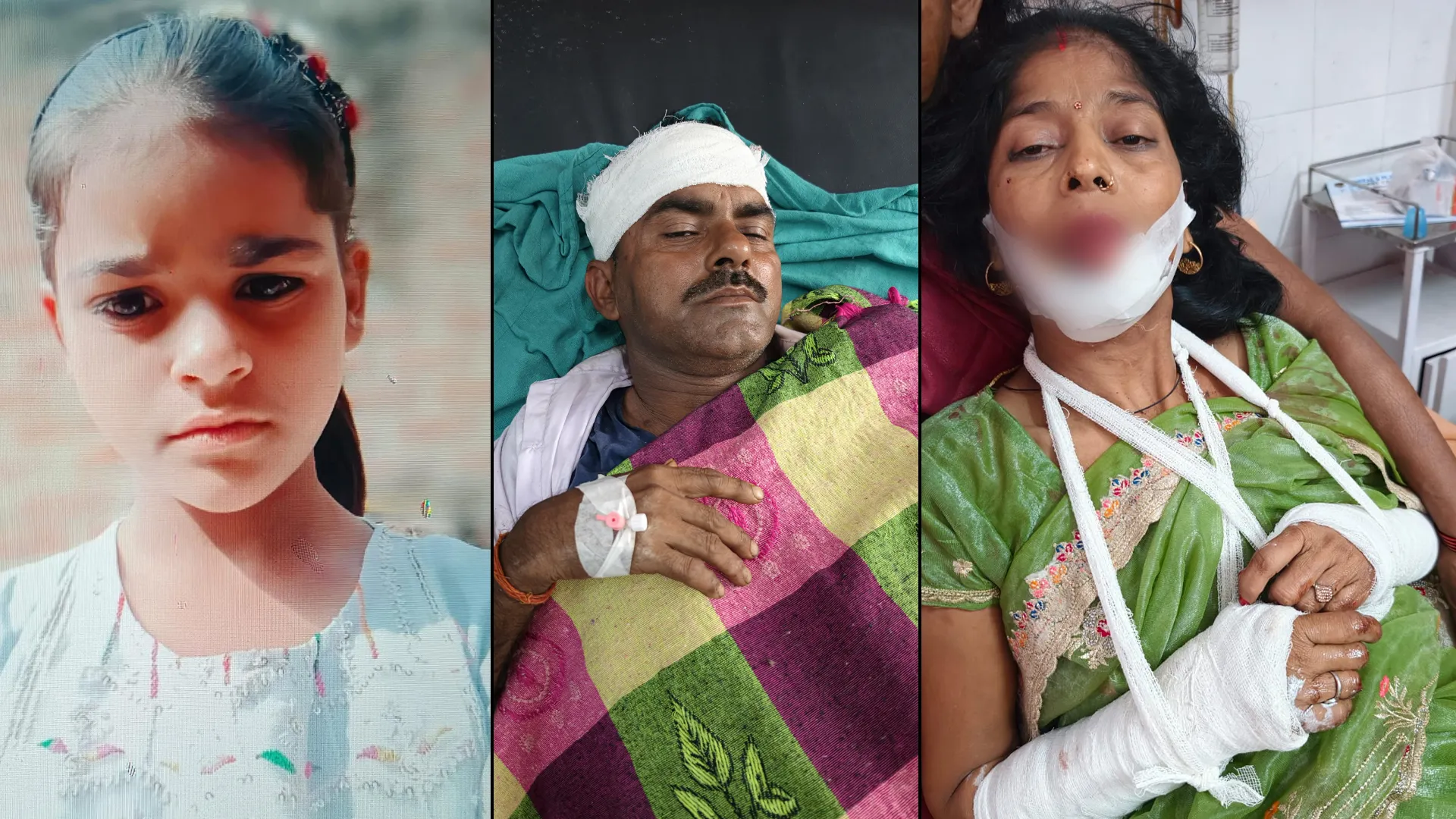 Rampur News : रोडवेज बस व ट्रैक्टर-ट्रॉली की टक्कर, किशोरी की मौत.. कईं बच्चों सहित 16 घायल