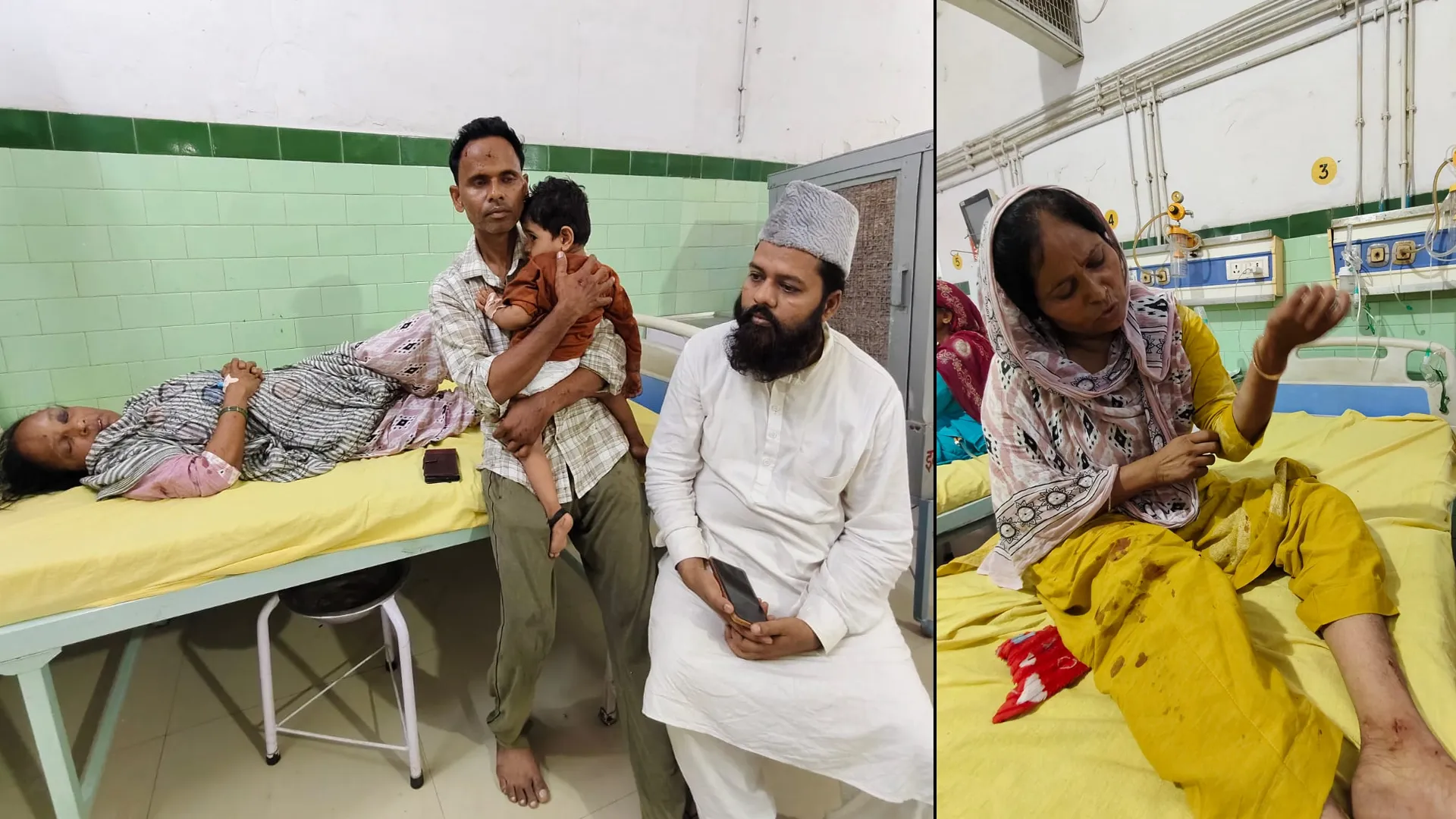 Bareilly News : अनियंत्रित होकर पलटी निजी बस, 50 से अधिक घायल.. चालक को झपकी आने से हुआ हादसा