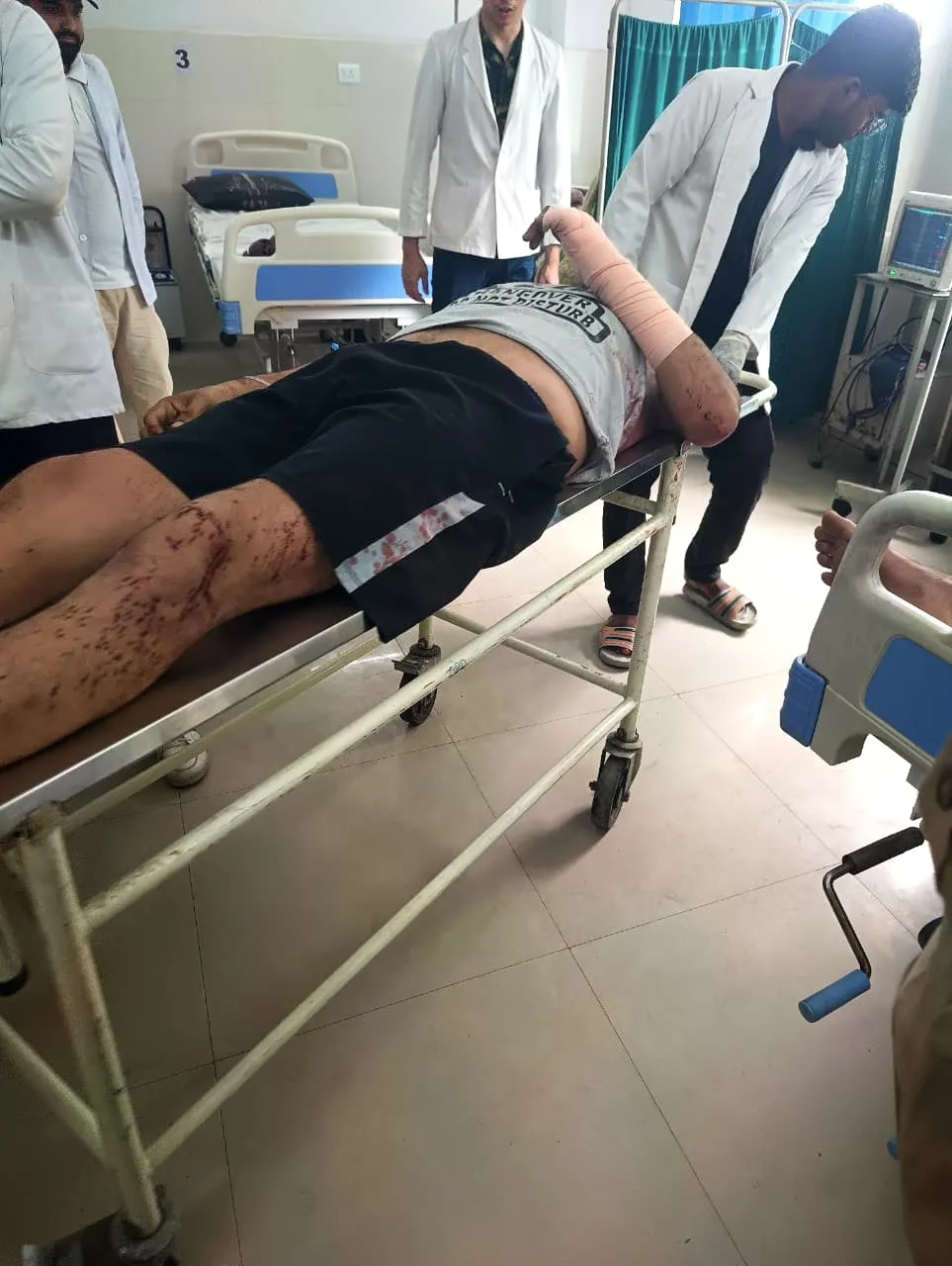  मोबाइल पर स्टेटस लगा असिस्टेंट प्रोफेसर ने काटी कलाई की नस 