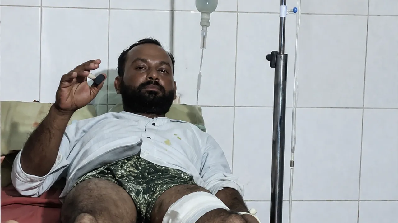 Sitapur Crime: लखनऊ-बरेली हाईवे पर दिनदहाड़े फायरिंग, दो जगह चली गोलियां, दो युवक घायल
