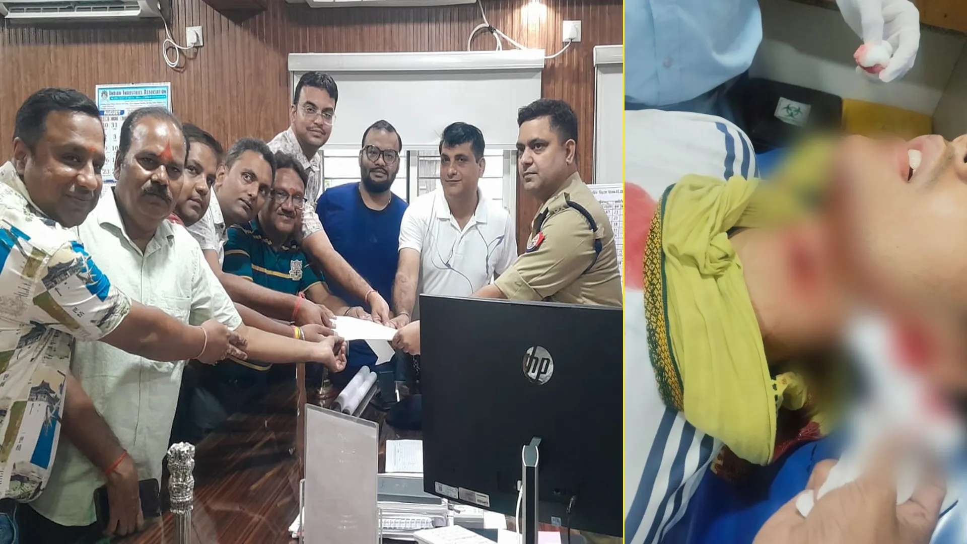 Bareilly News : चाइनीज मांझे से फिर बहा खून, महादेव पुल पर वैभव का गला कटने के बाद अब विद्युतर्की घायल