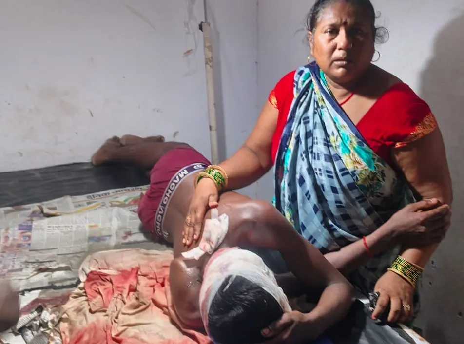Lakhimpur Kheri : बेटे पर हमला देख भिड़ गये पिता, युवक को छोड़कर भागा तेंदुआ 