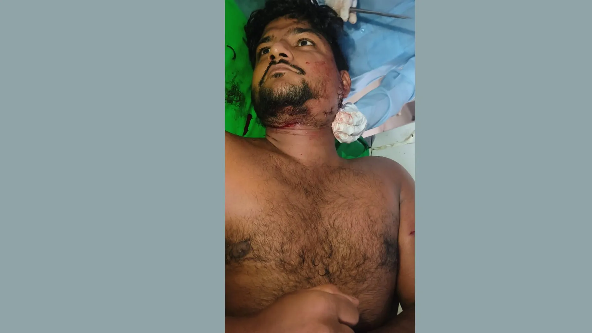 Moradabad News : किसान पर हमला करने वाला आदमखोर तेंदुआ पकड़ा, चाचा-दादी की दिलेरी से बची ललित की जान 