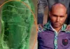  मेडिकल कॉलेज पहुंचा जहरीला सांप, हमरजेंसी वार्ड में अफरा-तफरी, युवक की मौत